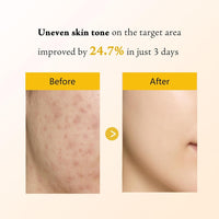 Kojic Acid Turmeric Overnight Wrapping Peel Off Mask – Brightens & Defends Against Skin Stress for a Clear, Glowing Complexion, Korean Skincare Facial Mask, 2.65 fl. oz.