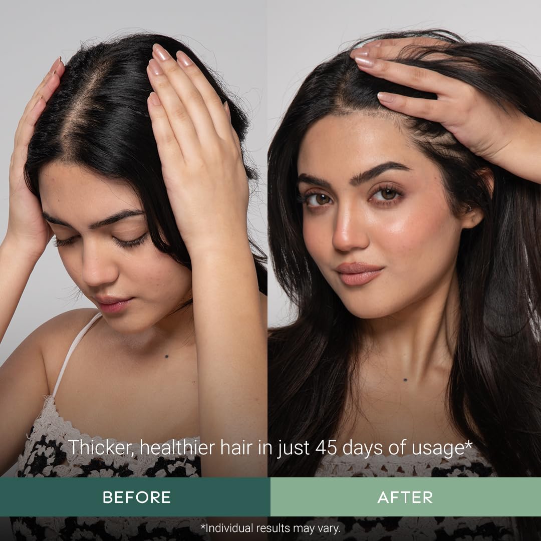 Arata Undiluted Rosemary Essential Oil For Hair Growth, Hair Fall Control & Nourishment | 100% Natural and Pure Blend | Strengthens Hair & Balances Scalp | 15ML