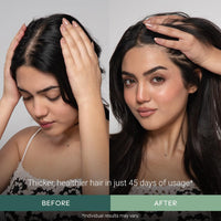 Arata Undiluted Rosemary Essential Oil For Hair Growth, Hair Fall Control & Nourishment | 100% Natural and Pure Blend | Strengthens Hair & Balances Scalp | 15ML