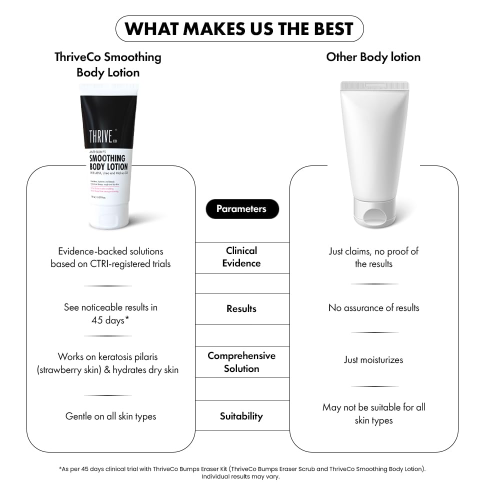 ThriveCo Smoothing Body Lotion for Dry, Rough & Bumpy skin | With AHA, Mahua Oil & Urea | Moisturizes, Hydrates & Treats Keratosis Pilaris,Strawberry Skin in Men & Women | 150 ml