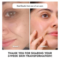 Cos-IQ Glowing Skin with Vitamin C-23% Serum : Advanced Molecular Skincare Technology 60ml | 23% Vitamin C Face Serum for Brightening Skin | Only 2 Ingredients Formula For Men and Women | 60 Days Pack