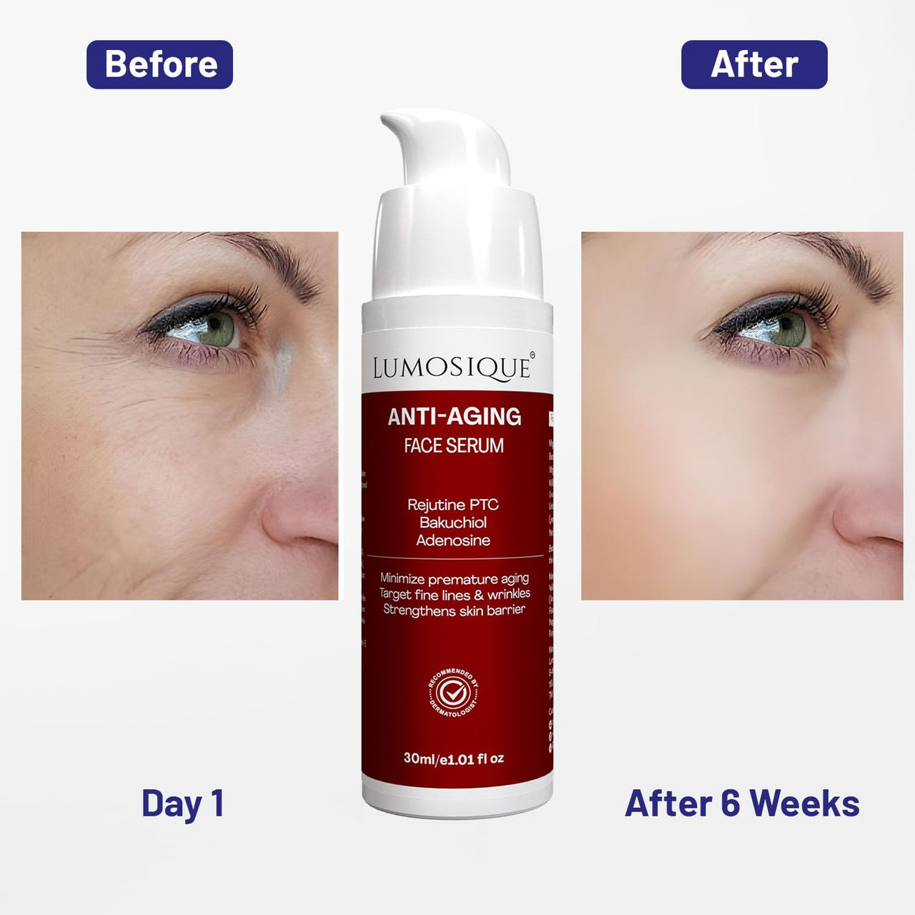 LUMOSIQUE® Anti Aging Natural Retinol Face Serum for Fine lines & Wrinkles Reduces Premature Ageing Targets Saggy Skin & Crow’s Feet, Retain Moisture | For Men & Women | 30ml