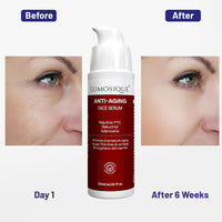 LUMOSIQUE® Anti Aging Natural Retinol Face Serum for Fine lines & Wrinkles Reduces Premature Ageing Targets Saggy Skin & Crow’s Feet, Retain Moisture | For Men & Women | 30ml