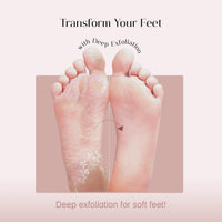 SeoulSkin Glycolic Acid Foot Peeling Mask, 150000 PPM (1 Pair) Korean Peeling & Exfoliating | Deep Exfoliation with Glycolic Acid, Hydrates & Softens, Removes Dead Skin, Cruelty-Free, Vegan, Paraben-Free Foot Peel Off Mask for All Skin Types