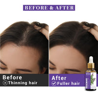 Sesa Rosemary Essential Oil For Hair Growth Nourishes Skin Hair Fall Control Oil For Women and Men 100% Pure & Natural Rosemary Oil, 30 ml