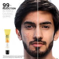 Ustraa Anti-Acne Spot Gel - 15 ml (Set of 2) | Reduces 99.9% Pimple-causing Germs | 2% Salicylic Acid - Removes Dead Skin & Clears Pores | Dermatologically Tested | Oil-free | Reduces Acne & Redness