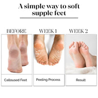 LuxaDerme Peeling & Exfoliating Foot Mask for Baby Soft Feet | Removes Dry Skin & Hard Calluses | Hydrates Dry Feet (Pack of 2)
