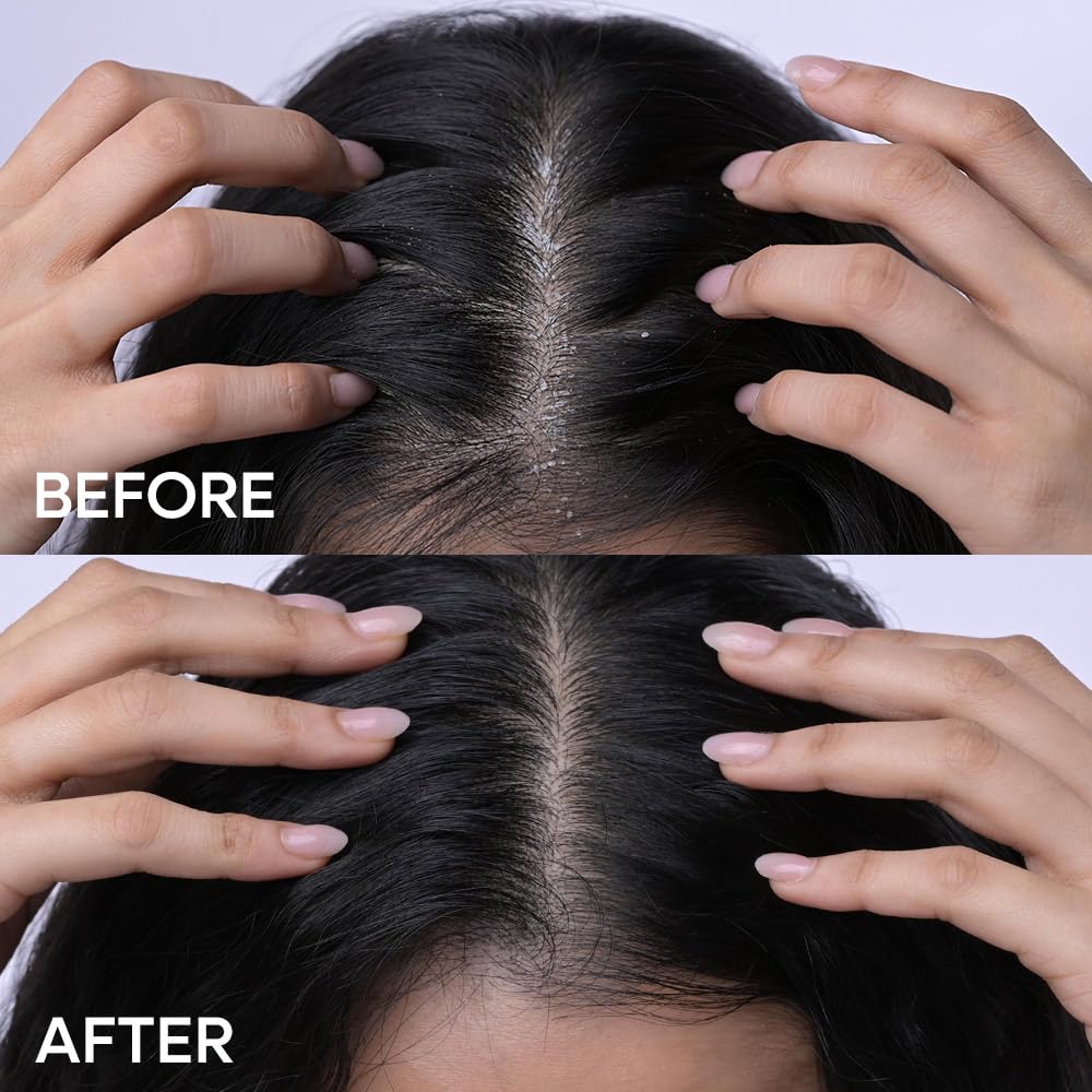 Naturali Anti-Dandruff Hair Mask With Sage & Salicylic Acid | Clarifies Scalp | Reduces Itchiness | Deeply Moisturises | Paraben & Mineral Oil Free | 200ml