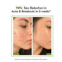 Conscious Chemist 2% Salicylic Acid Serum | 30ml | Face Serum for Acne, Blackheads & Opne Pores, Reduce Excess Oil & Bumpy Texture, BHA Based Exfoliant for Acne, Face Serum for Men & Women - Flashfix