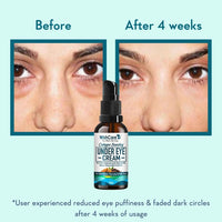 WishCare ® Collagen Boosting Under Eye Cream For Dark Circles & Wrinkles - Enriched with Caffeine, Almond Milk, Vitamin C& E, Hyaluronic Acid, Retinol for all skin type - 30ml