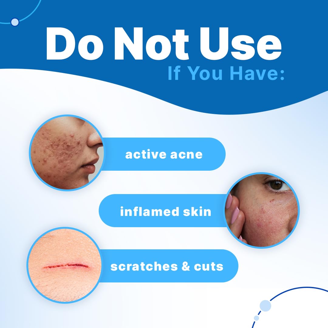 Sotrue Charcoal Nose Pore Deep Cleansing Strips | For Blackheads and Whiteheads Removal | Aloe vera Extract, Activated Charcoal | Pack of 4 Nose Strips