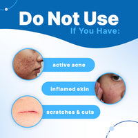 Sotrue Charcoal Nose Pore Deep Cleansing Strips | For Blackheads and Whiteheads Removal | Aloe vera Extract, Activated Charcoal | Pack of 4 Nose Strips