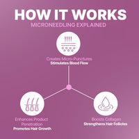 Sotrue Derma Roller 0.5mm with Sanitizer | 540 Stainless Steel Needles | Derma Roller for Hair Growth & Thickening, Repair Damages and Activates Hair Follicles, Reduces Acne Scars (Black)