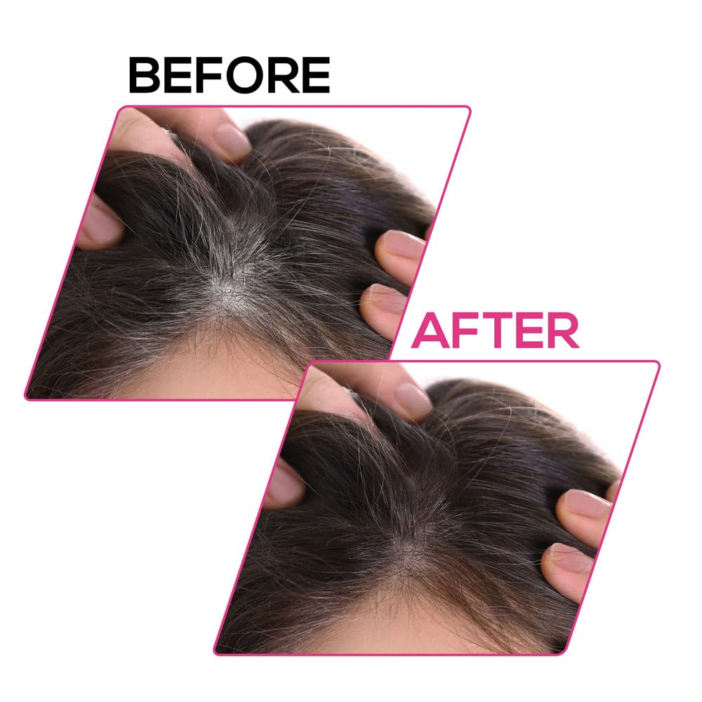 RENEE Cover-Up Hair Powder- Brown, Helps Cover Grey Roots & Bald Spots Instantly, Highly Pigmented, Fuller and Denser, Long-Lasting & Matte Finish, Fine Powder for Flawless Application, 4gm