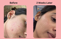 Peach and Musk Refreshing Oil Control Facewash, 2% Salicylic Acid with Ginseng, Controls Oil and Reduces Acne, Sulphate & Parabens Free, Soap Free Face Wash - 100gm