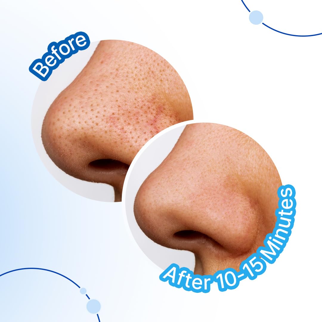 Sotrue Charcoal Nose Pore Deep Cleansing Strips | For Blackheads and Whiteheads Removal | Aloe vera Extract, Activated Charcoal | Pack of 4 Nose Strips