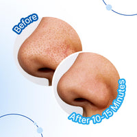 Sotrue Charcoal Nose Pore Deep Cleansing Strips | For Blackheads and Whiteheads Removal | Aloe vera Extract, Activated Charcoal | Pack of 4 Nose Strips