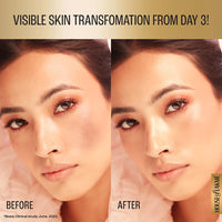 Lakmé Perfect Radiance Serum 15ml