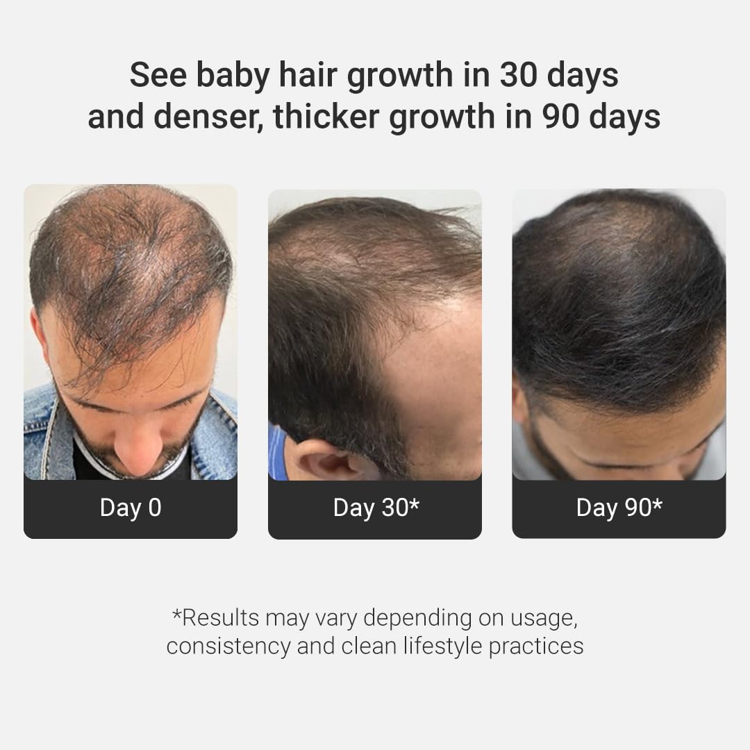 Arata Grow Strong Combo | Intensive Hair Growth Serum & Super Shampoo | Boost Hair Growth | Reduce Hair Loss | Smooth & Shiny Hair | 3% Redensyl, Biotin, Protein, Vitamins | 300ml + 30ml