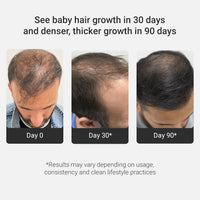 Arata Grow Strong Combo | Intensive Hair Growth Serum & Super Shampoo | Boost Hair Growth | Reduce Hair Loss | Smooth & Shiny Hair | 3% Redensyl, Biotin, Protein, Vitamins | 300ml + 30ml