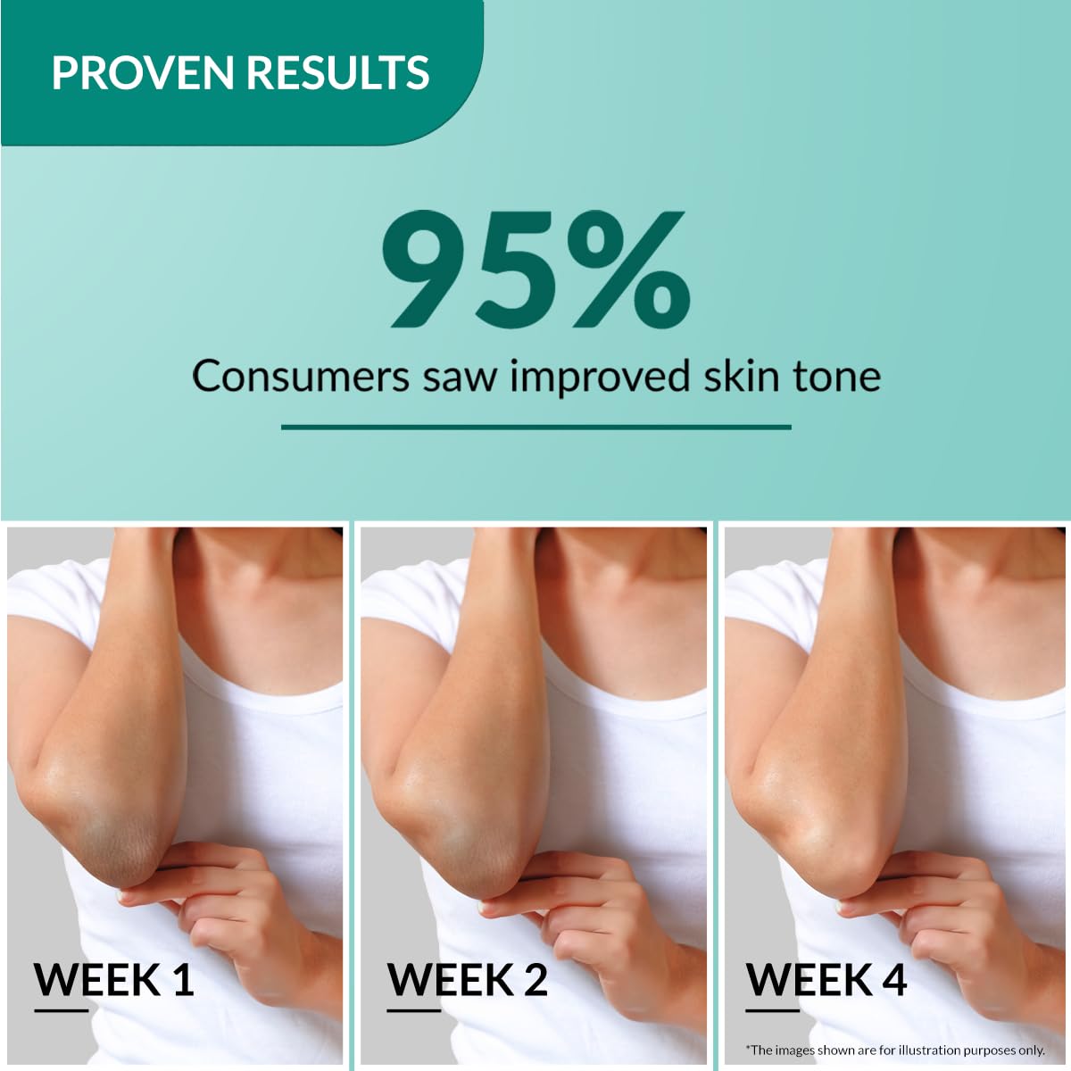 Fixderma Nigrifix Cream for Acanthosis Nigricans with Lactic Acid | Dermatologist Tested Retinol Cream | For Dark Body Parts like Neck, Ankles, Knuckles, Armpits, Thighs & Elbows | Exfoliant - 50g