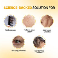 Sotrue Professional Derma Roller For Hair Growth 1 mm with 192 Stainless Steel Needles | Repairs Damaged Hair, Activates Hair Follicles | For Hair Fall & Hair Thickening | Reduces Acne Scars | Safe & Effective To Use