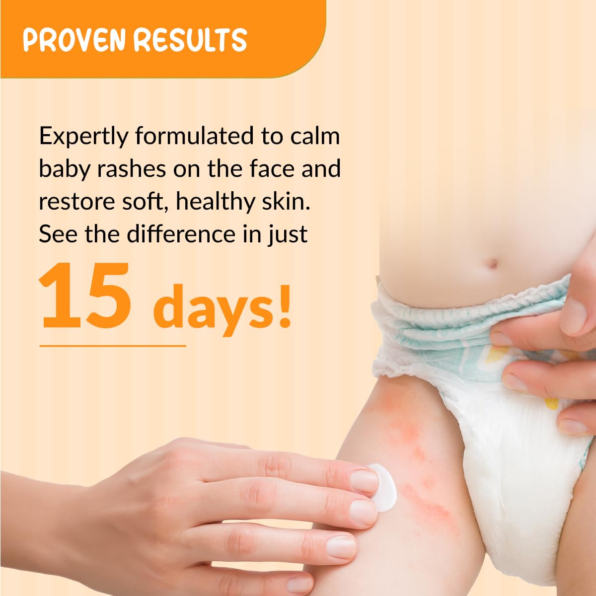 Fixderma Hoopoe Diaper Rash Cream for baby with Zinc Oxide & Panthenol | Prevent Rashes, Redness & Irritation | Baby Rash Cream | Dermatologist Tested (50G)