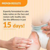 Fixderma Hoopoe Diaper Rash Cream for baby with Zinc Oxide & Panthenol | Prevent Rashes, Redness & Irritation | Baby Rash Cream | Dermatologist Tested (50G)