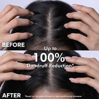 Naturali Shampoo For Dandruff | Tea Tree Oil For Hair | Sulphate Free | Dandruff Shampoo For Men | Paraben Free | 370 ml