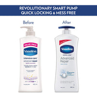 Vaseline Derma Care Advanced Repair Body Lotion|For Sensitive Dry Skin| Non Greasy|Long Lasting Moisturisation|400 ml
