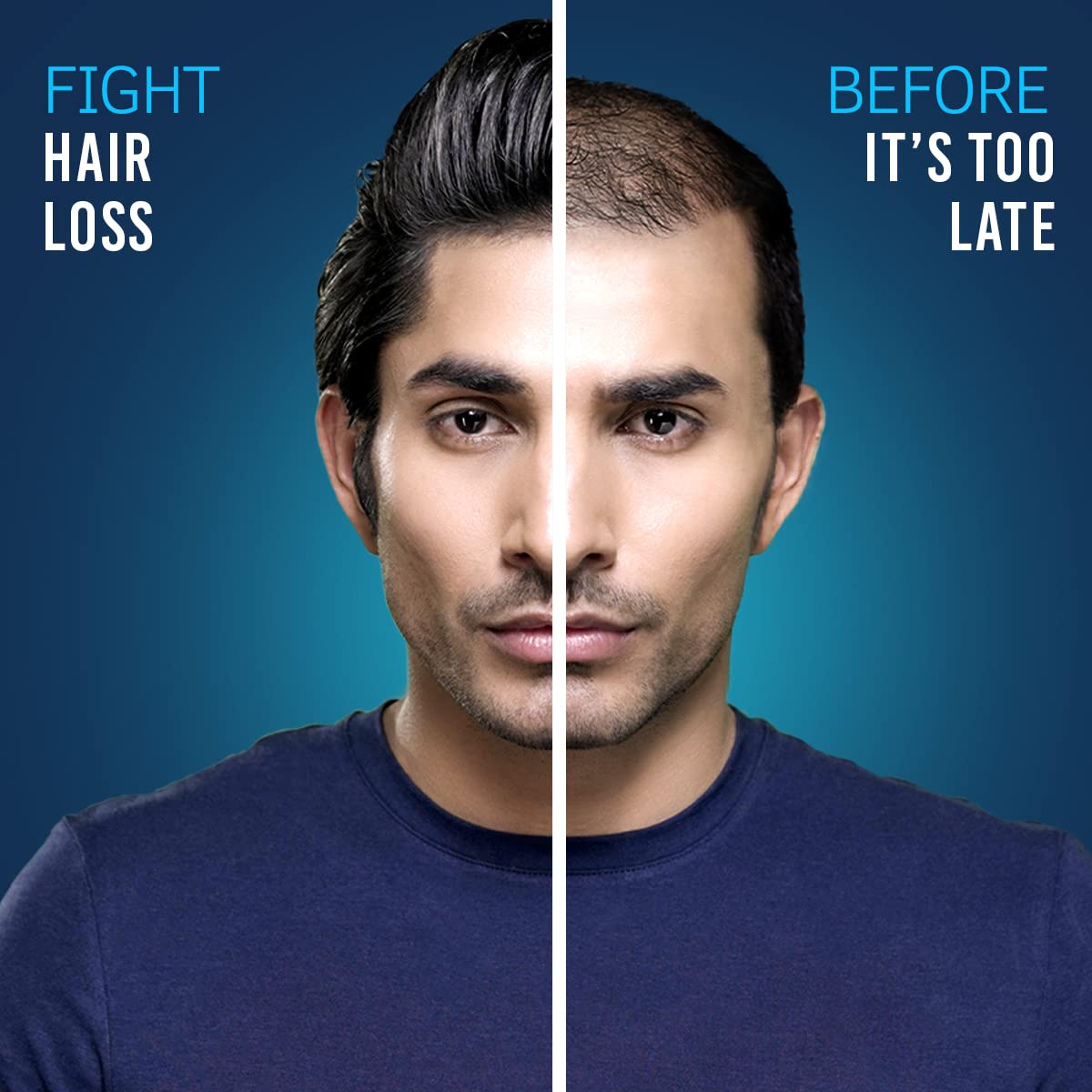 USTRAA Hair Growth Cream - 100 g - with Onion Extract, Neelbhringadi, Blackseed Oil - Helps boost hair growth, Prevents hair fall - No Parabens, No Mineral Oil