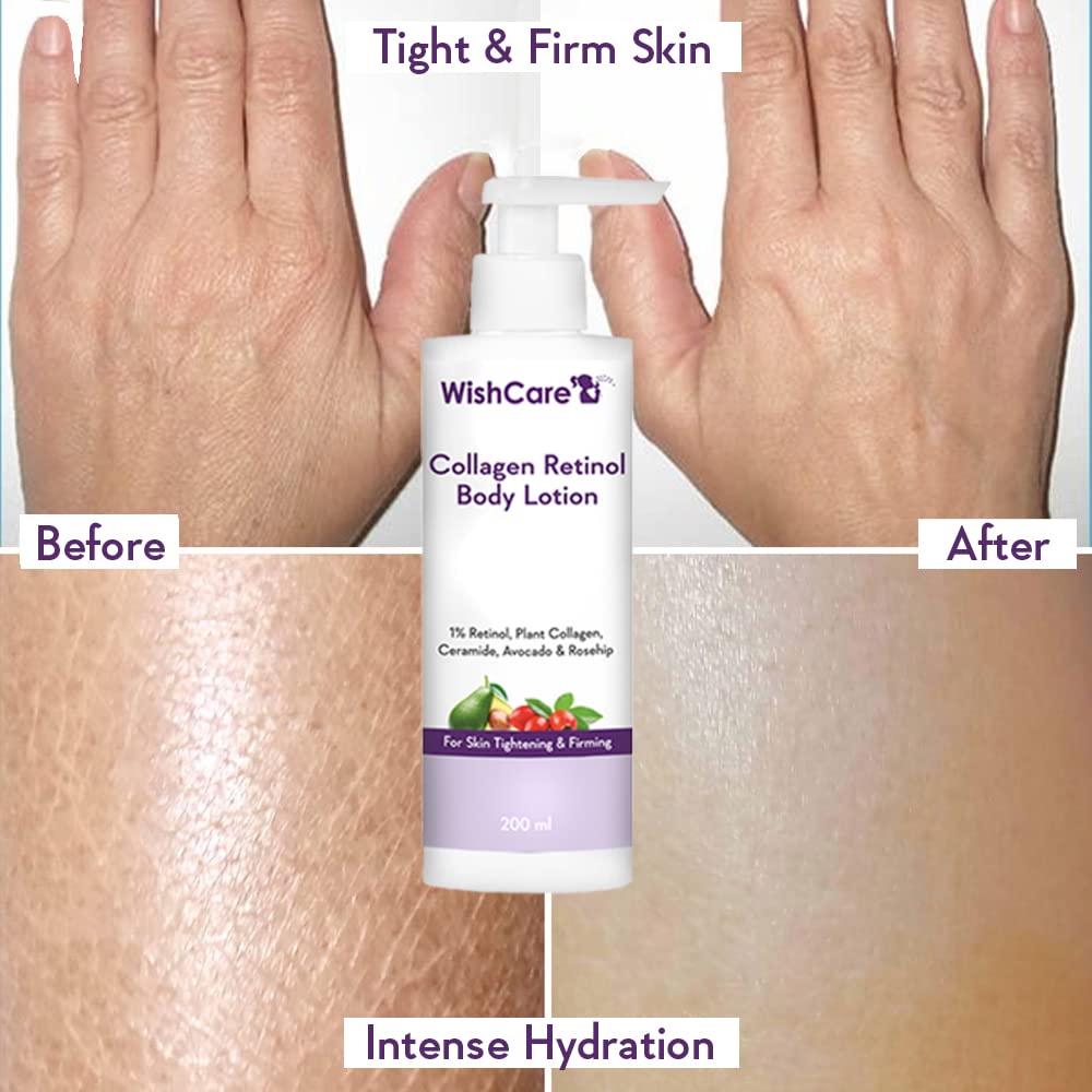 WishCare Collagen 1% Retinol Body Lotion - For Skin Tightening & Firming - With Niacinamide, Ceramide, Rosehip & Avocado - For Men & Women - 200 Ml