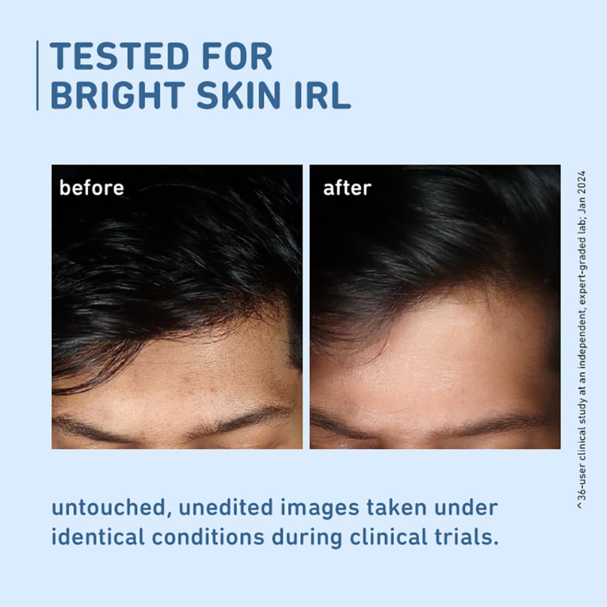 Plum 10% Niacinamide Serum with Rice Water | Provides Clear, Glowing & Brightening Skin | for Acne Prone, Combination, Oily & Sensitive Skin | Oil Control & Anti Acne Face Serum for Women & Men | 30ml