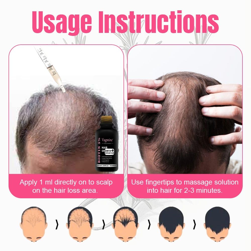 Vagmine Hair Growth Serum Plus With Biotin 5% & Rosemary - 60ml | Natural Treatment for Stronger, Thicker Hair | Promotes Healthy Hair Growth | Nourishes Scalp & Helps in Reduces Hair Fall