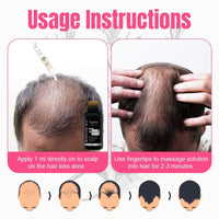 Vagmine Hair Growth Serum Plus With Biotin 5% & Rosemary - 60ml | Natural Treatment for Stronger, Thicker Hair | Promotes Healthy Hair Growth | Nourishes Scalp & Helps in Reduces Hair Fall