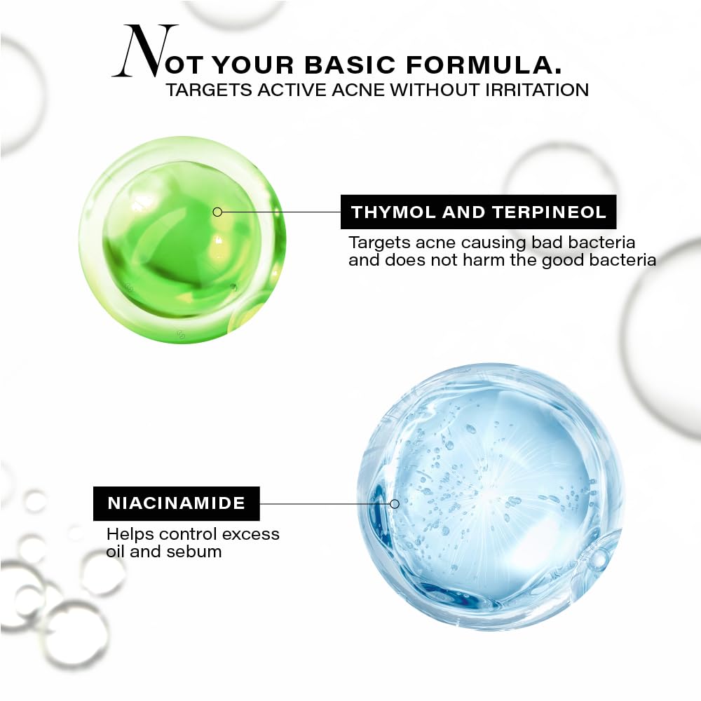 Novology Acne Clearing Serum with Thymol and Terpineol | Face Serum For Acne, Whiteheads, Blackheads | Non-sticky, Non-Irritating, Non-Comedogenic| For Oily, Acne Prone Skin | 28 ML