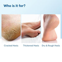 Be Bodywise 20% Urea Foot Cream Roll On 75ml | For Dry & Cracked Heels | With 2% Lactic Acid, Vitamin E & Olive Oil | Helps Moisturise and Repair Cracked Heels