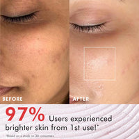 mcaffeine Berries Brightening Coffee Face Scrub For Glowing Skin | Gently Exfoliates, Smoothes & Improves Skin Tone | Removes Tan & Dead Skin | For Women & Men - Pack Of 2 - 75Gm