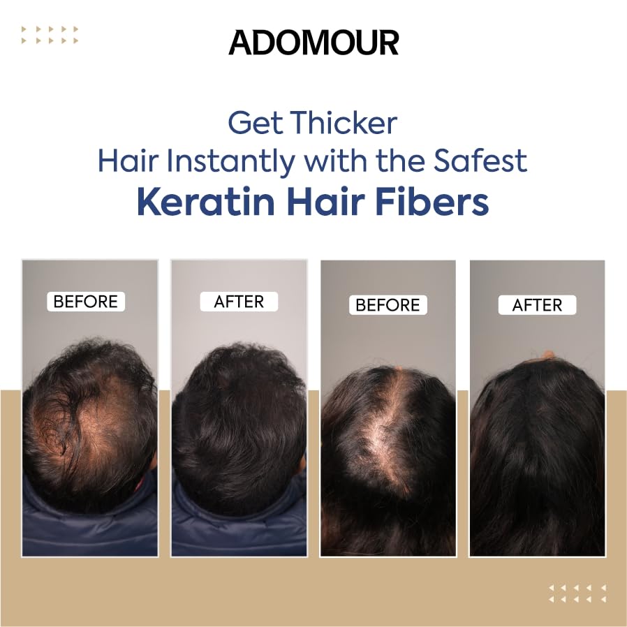 Adomour Hair Building Fiber 27.5g | Keratin Fibers for Thin, Fine & Thinning Hairs | Natural Coverage | For Thickening & Volumizing | Bald Spot Cover Up Hair Fiber Powder for Men & Women (Dark Brown)