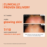 Plum 15% Vitamin C Serum for Glowing Skin | for Oily, Dry & Combination Skin | Reduce Pigmentation & Dark Spot |with Mandarin | Non-Irritating, Hydrating & Soothing | Face Serum for Men & Women | 20ml