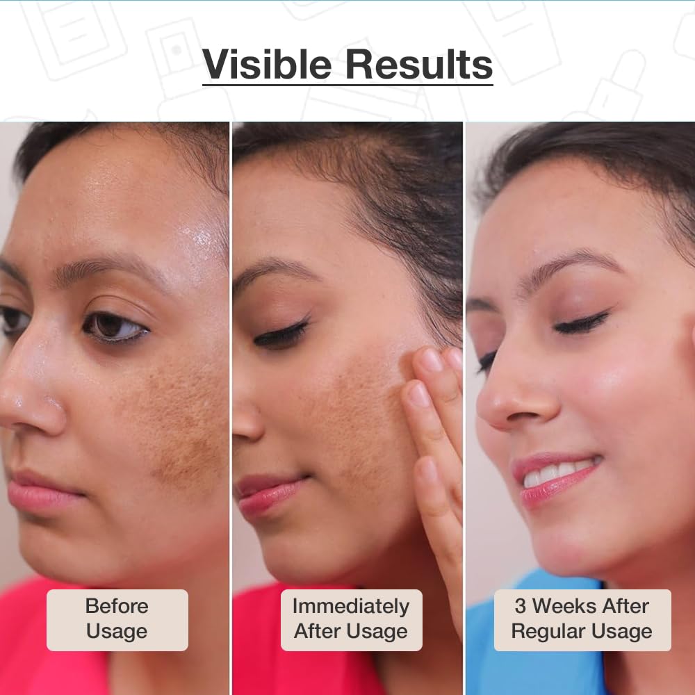 Cos-IQ Complete Kit for Fighting Hyperpigmentation, Glycolic Acid Face Cleanser 100ml, SPF 50 Sunscreen 30ml, Vitamin C-8% Serum, ABP-33% Strong Exfoliating, Niacinamide Vitamin B3-20% Serum, 30ml