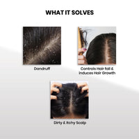 ThriveCo Hair Fall & Repair Kit | Exfoliating Scalp Scrub (25ml) | Vitalizing Serum (10ml) | Hair Serum 2.0 Roll On | Promotes Hair Growth, Clears Dandruff & Buildup | Travel-Friendly