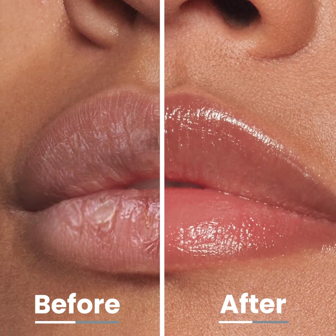 Hyphen All I Need Lipscreen with Spf 30 & 2% Kojic Acid -Moisturizing, Sun Protection|Smooth Lips, Tan Removal for Women and Men|Lip Balm Spf|Chapped Dry Lips | Peptide|Vegan,Sls & Paraben-Free -10 Gm