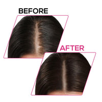 RENEE Cover-Up Hair Powder- Brown, Helps Cover Grey Roots & Bald Spots Instantly, Highly Pigmented, Fuller and Denser, Long-Lasting & Matte Finish, Fine Powder for Flawless Application, 4gm