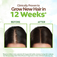 Mamaearth Rosemary Hair Growth Oil with Rosemary & Methi Dana for Promoting Hair Growth | Controls Hair Fall | Strengthens Hair | Stimulates New Hair Growth | Healthy Nourished Hair | 200 ml