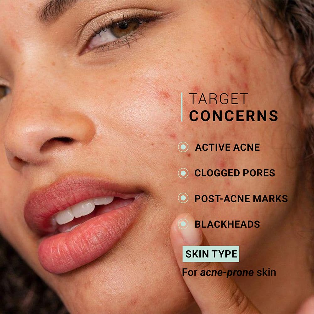 Sereko Clear Corrective Serum with 2% Encapsulated Salicylic Acid BHA & 3% Azelaic Acid | Active Acne | Reducing Sebum Production | Pigmentation & Dark Spots for Oily | Acne-Prone Skin 30ml - Pack 1