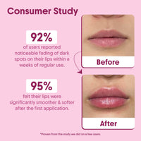 Aravi Organic Beetroot Lip Scrub with Shea Butter & Cocoa Butter – For Dark, Chapped & Pigmented Lips – Suitable for Men and Women – 15 gm