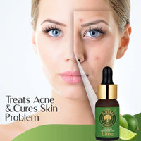 Old Tree Pure Lime Essential Oil for Skin, Hair, Diffuser, Candle Making (15ml) - Undiluted and Natural Perfume Oil with Dropper for Fragrance, Stress Relief and Aromatherapy