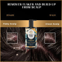 Wildly Pure Clarifying Shampoo for Hard Water & Metal Damage | For Oily Scalp & Low Porosity Hair | Deep Clensing removes Built Up & flakes | Rosemary, Hibiscus & Castor Oil | Sulphate, Paraben & Silicone Free | Men & Women | 300 ml (Reset)