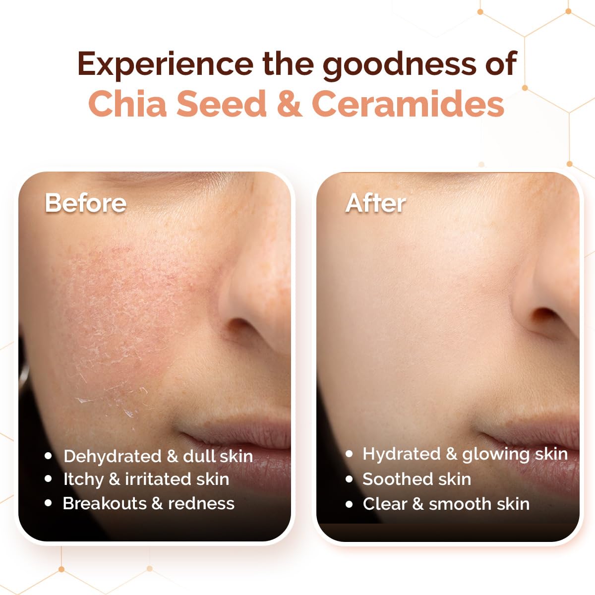 Mamaearth Chia Calming Moisturizer with Chia Seed & Ceramides for Healthy Skin Barrier | For Hydrated Glow | Co-Created with Dermats | For Dry & Sensitive Skin | 24H Long Lasting Moisturization | Fragrance Free | 80 g